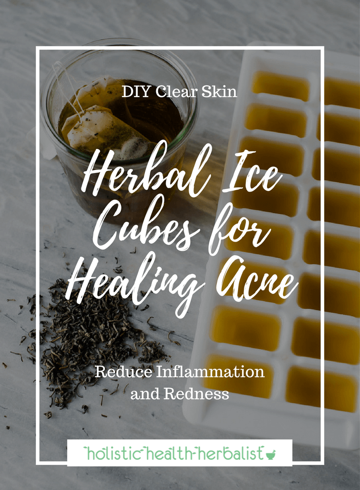 Herbal Ice Cubes for Acne - Learn how to make soothing herbal ice cubes for calming red inflamed blemishes.