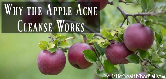 Why the Apple Acne Cleanse Works