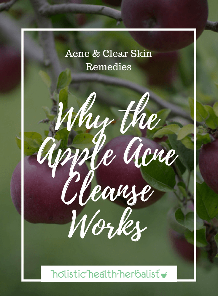 Why the Apple Acne Cleanse Works - Learn why this unconventional cleanse works so well for clearing acne, sometimes in as little as three days!