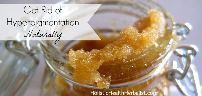 Get Rid of Hyperpigmentation Naturally