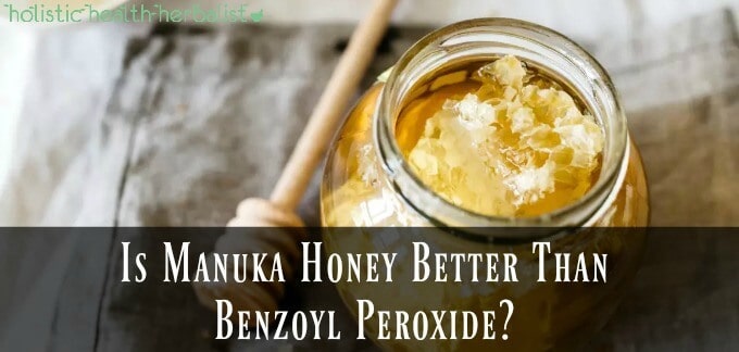 Is Manuka Honey Better Than Benzoyl Peroxide?