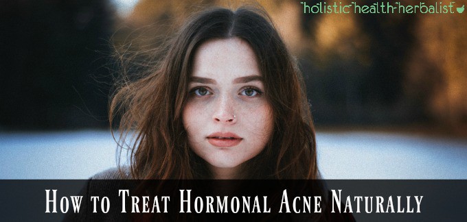 How to treat Hormonal Acne Naturally - girl with clear skin.
