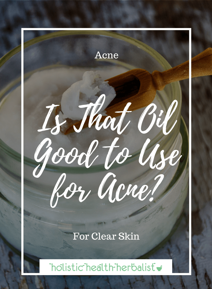 Is That Oil Good to Use for Acne? - Find out the comedogenic ratings of the most popular oils used for acne prone skin.