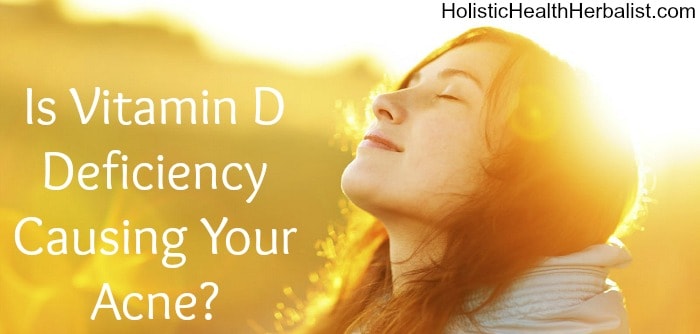 Is Vitamin D Deficiency Causing Your Acne?