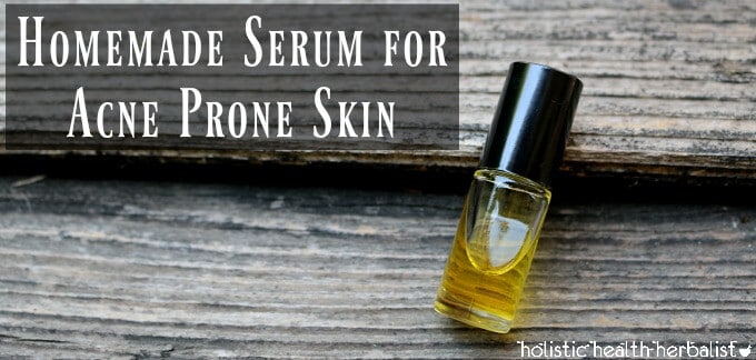 Homemade Serum for Acne Prone Skin