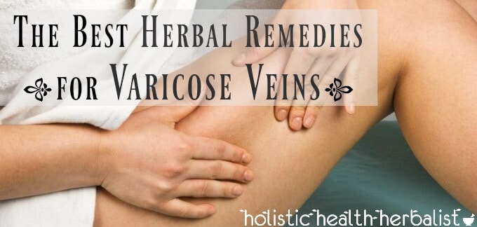 The Best Herbal Remedies for Varicose Veins