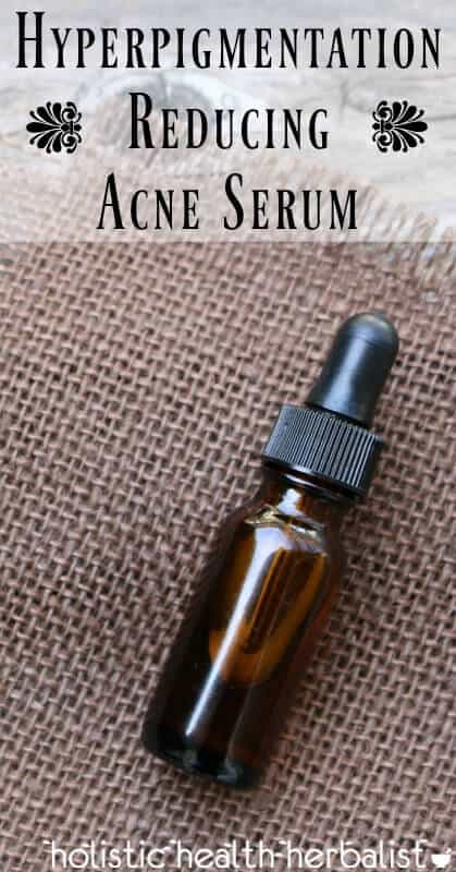 Hyperpigmentation Reducing Acne Serum - Reduce dark spots naturally using essential oils.
