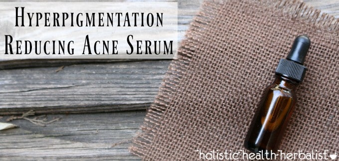 Hyperpigmentation Reducing Acne Serum