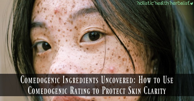 Girl with acne - comedogenic ingredients and their comedogenic rating