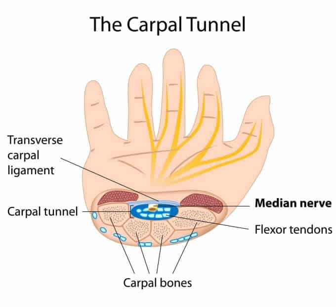 how to heal carpal tunnel