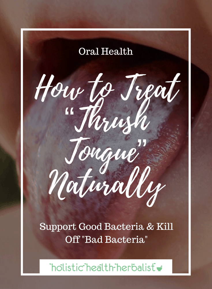 How to Treat “Thrush Tongue” Naturally - Learn how to use natural remedies to treat oral thrush and rebalance good bacteria in the mouth and digestive tract.